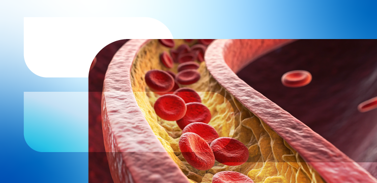 Подход к снижению риска дислипидемии находится за пределами коррекции уровня холестерина ЛПНП