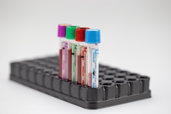 Можно ли изменить порядок взятия пробирок при венепункции?