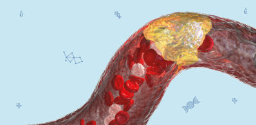 Причины появления хилезного образца