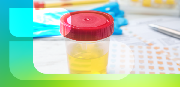 Преаналитические требования к анализу мочи