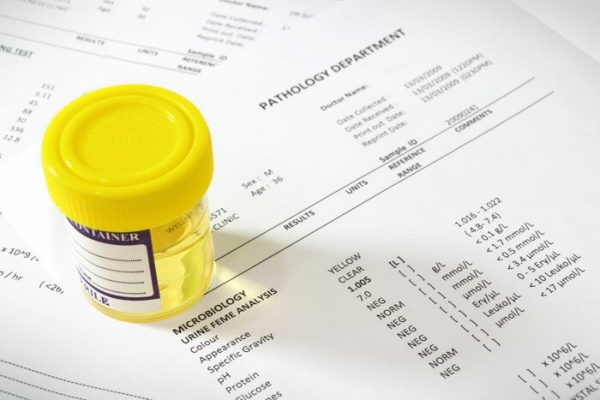 Простое изменение может значительно сократить количество ненужных анализов на инфекции мочевыводящих путей