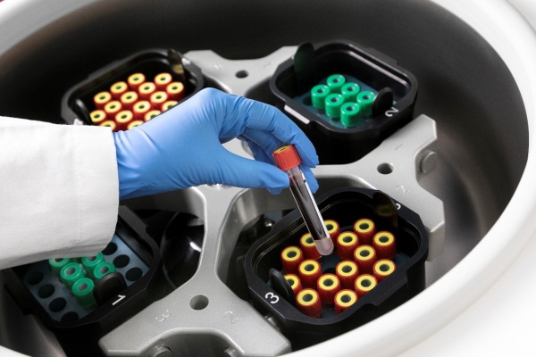 Системы для взятия венозной крови. Как выбрать пробирки для взятия крови?