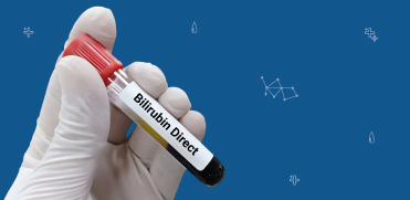 Иктеричность образца крови