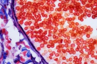 Новые открытия в ранней диагностике внутренних кровотечений с помощью системы Early Bird.