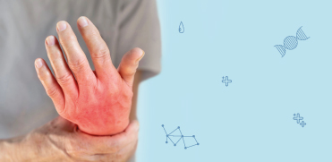 Точность результатов при самостоятельном взятии капиллярной крови у пациентов с ревматоидным артритом