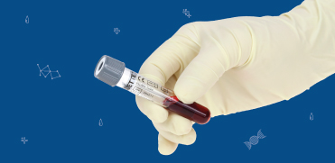 Ошибка в выборе пробирки при исследовании глюкозы