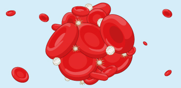 Влияние аспирина на агрегацию тромбоцитов, индуцированную инфекционными бактериями