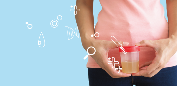 Оценка эффективности применения вакуумных пробирок для мочи с борной кислотой на примере одного учреждения