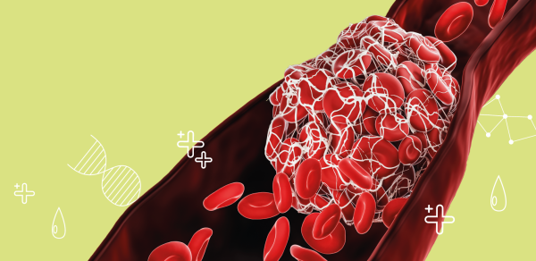 ДВС-синдром и Антитромбин III