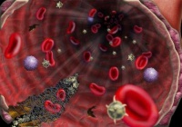 Тесты Волчаночного антикоагулянта и аномальной гипокоагуляции пациентов с Covid-19