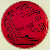 XLD Agar - Агар для селективного выделения Salmonella и Shigella