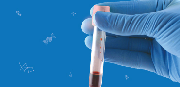 Влияние температуры и апротинина на стабильность АКТГ