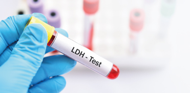 Можно ли определять ЛДГ в плазме крови?