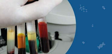 Гемолиз, липемия и иктеричность вызывают беспокойство в КДЛ