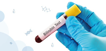 Влияние температуры и света на стабильность билирубина в плазме