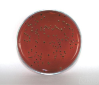 Eosin Methylene Blue Agar - Агар с эозином и метиленовым синим