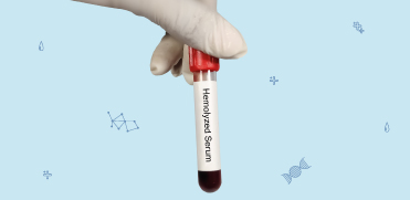 Основная причина выбраковки проб – гемолиз