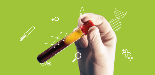 Ошибочно высокое измерение тропонина, вызванное сгустком фибрина: опыт одного учреждения