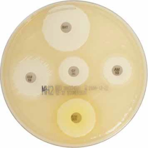 Агар Мюллер-Хинтона