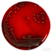 Columbia agar+5% horse blood - Колумбийский агар + 5 % лошадиной крови