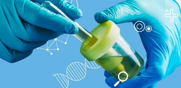 Влияние метода охлаждения и использования консервантов на стабильность проб мочи