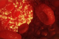 Эритроциты и сердечно-сосудистые заболевания при диабете