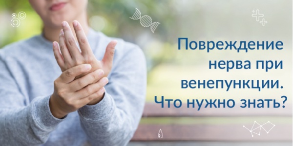 Повреждение нерва при венепункции. Что нужно знать?