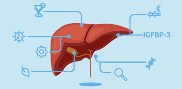 IGFBP-3 как прогностический биомаркер при циррозе печени