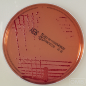 Yersinia CIN Agar - Агар для селективного выделения Yersinia