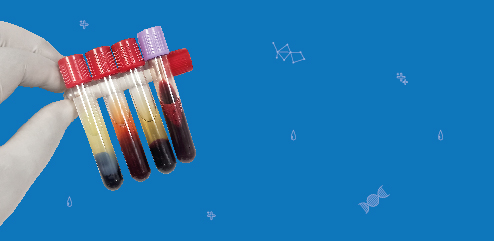 Оценка техники взятия венозной крови на основе определения количества проб с гемолизом и проб, содержащих сгустки