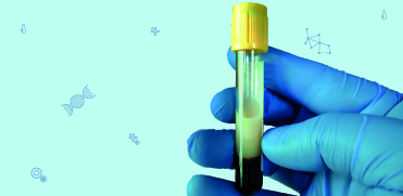 Оценка влияния липемии на рутинные клинические биохимические тесты