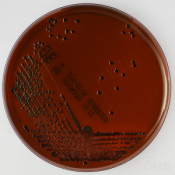 Eosin Methylene Blue Agar - Агар с эозином и метиленовым синим