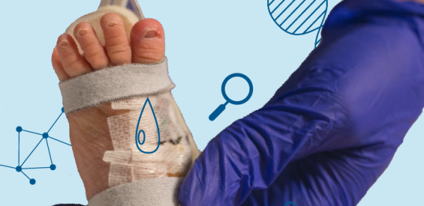 Лактат в диагностике неонатального сепсиса