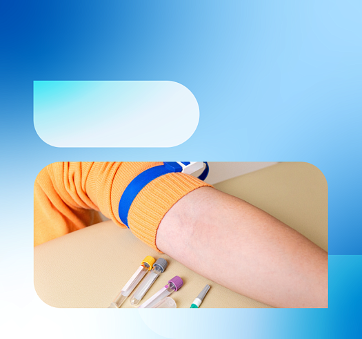 Влияние времени наложения жгута на концентрацию лактата в цельной крови