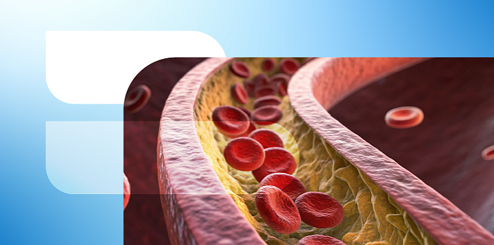 Подход к снижению риска дислипидемии находится за пределами коррекции уровня холестерина ЛПНП